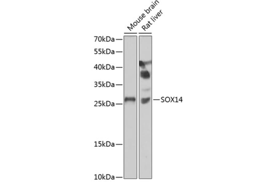 Western Blot - Anti-SOX14 Antibody (A15600) - Antibodies.com