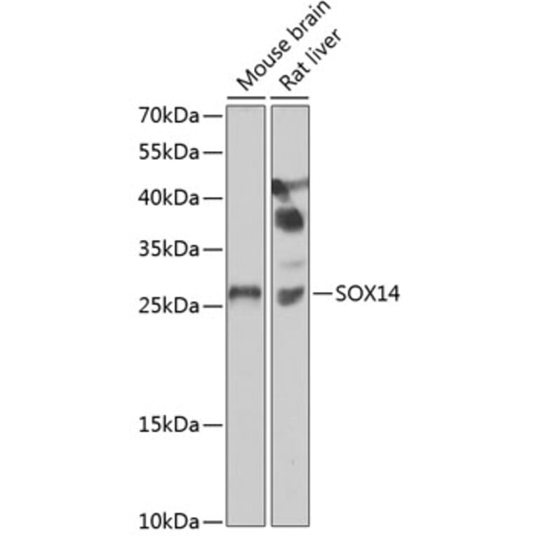 Western Blot - Anti-SOX14 Antibody (A15600) - Antibodies.com