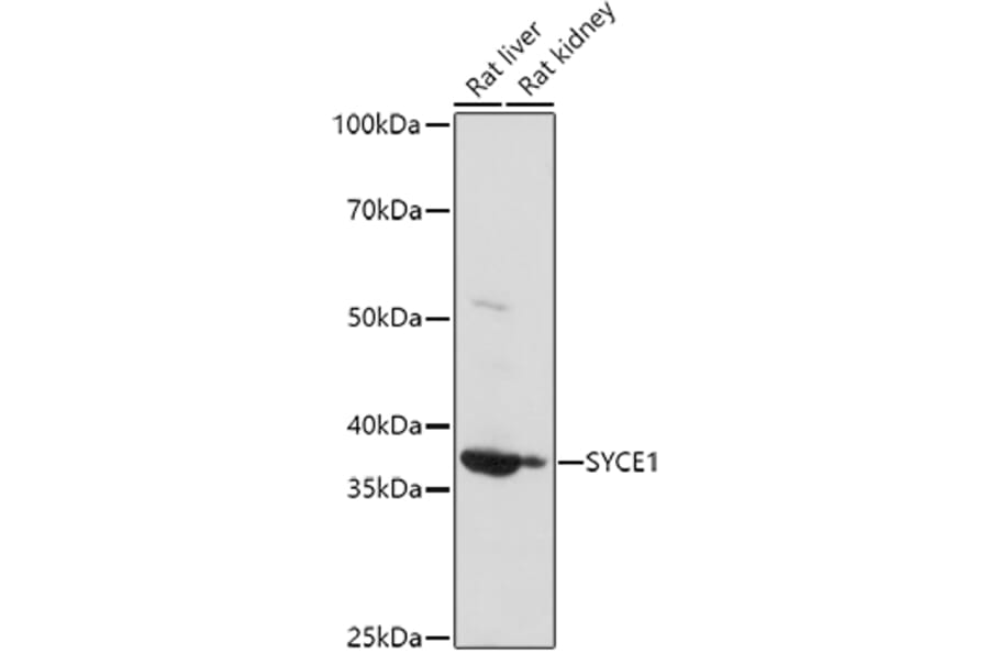 Western Blot - Anti-SYCE1 Antibody (A15601) - Antibodies.com