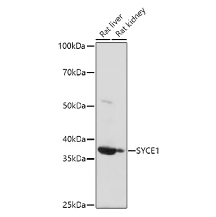 Western Blot - Anti-SYCE1 Antibody (A15601) - Antibodies.com