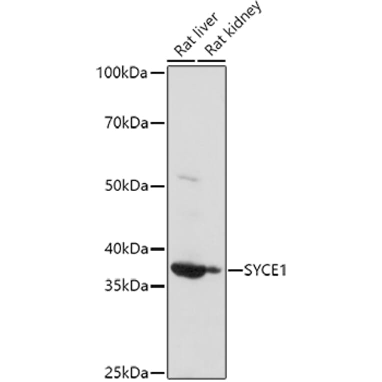 Western Blot - Anti-SYCE1 Antibody (A15601) - Antibodies.com