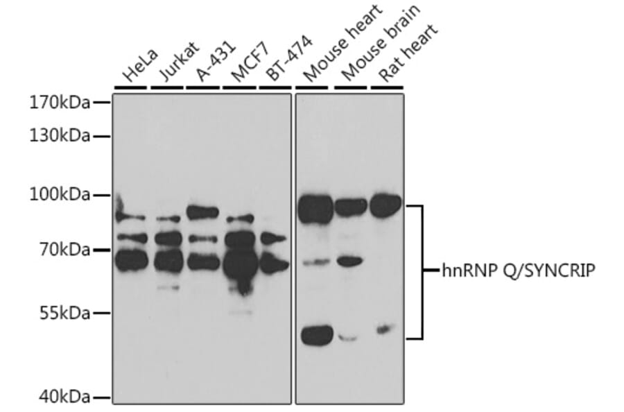 Western Blot - Anti-hnRNP Q Antibody (A15602) - Antibodies.com