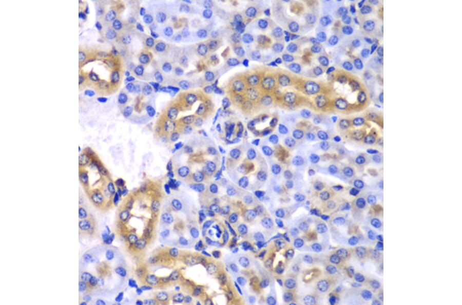 Immunohistochemistry - Anti-hnRNP Q Antibody (A15602) - Antibodies.com