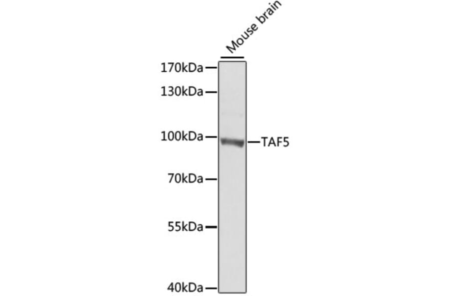 Western Blot - Anti-TAF5 Antibody (A7221) - Antibodies.com
