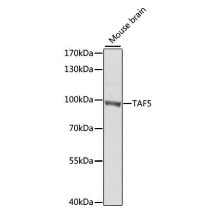 Western Blot - Anti-TAF5 Antibody (A7221) - Antibodies.com