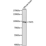 Western Blot - Anti-TAF5 Antibody (A7221) - Antibodies.com