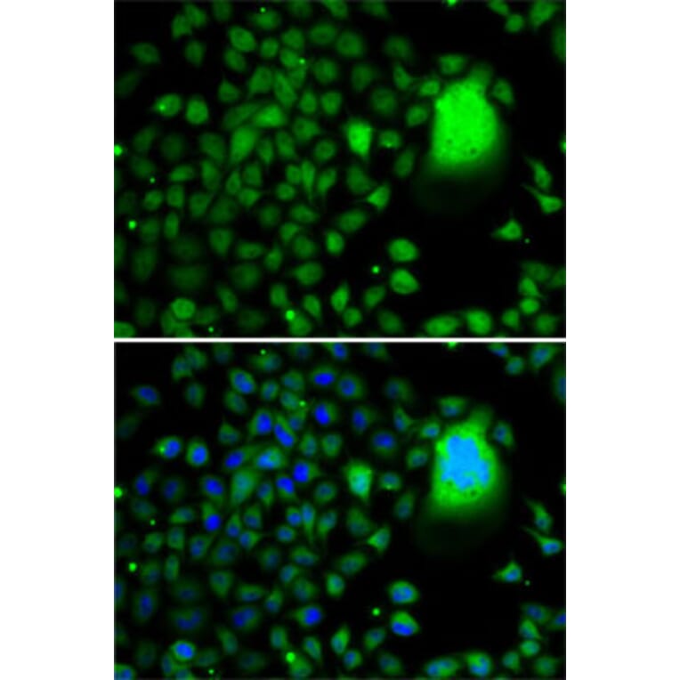 Immunofluorescence - Anti-TAF5 Antibody (A7221) - Antibodies.com