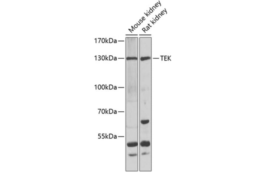 Western Blot - Anti-TEK Antibody (A7222) - Antibodies.com