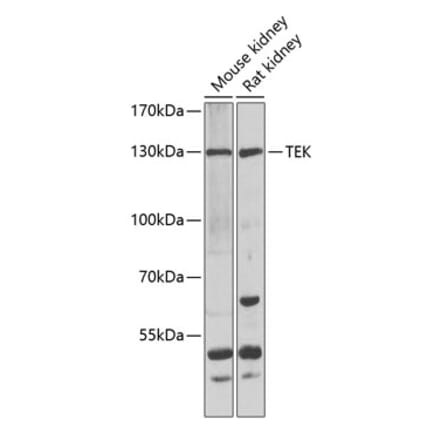 Western Blot - Anti-TEK Antibody (A7222) - Antibodies.com