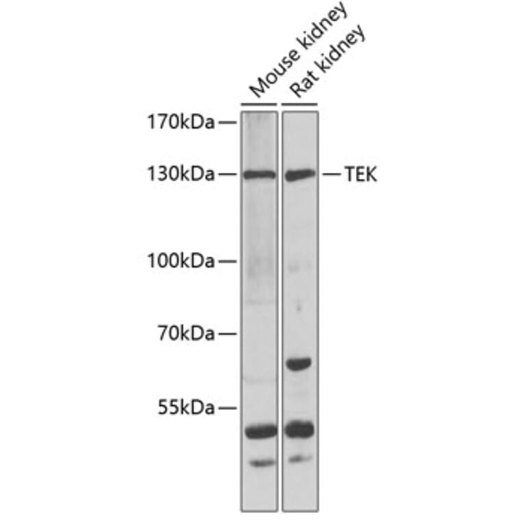 Western Blot - Anti-TEK Antibody (A7222) - Antibodies.com