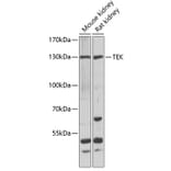 Western Blot - Anti-TEK Antibody (A7222) - Antibodies.com