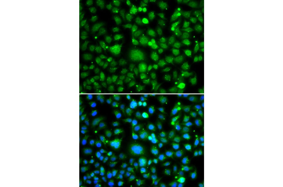 Immunofluorescence - Anti-TEK Antibody (A7222) - Antibodies.com