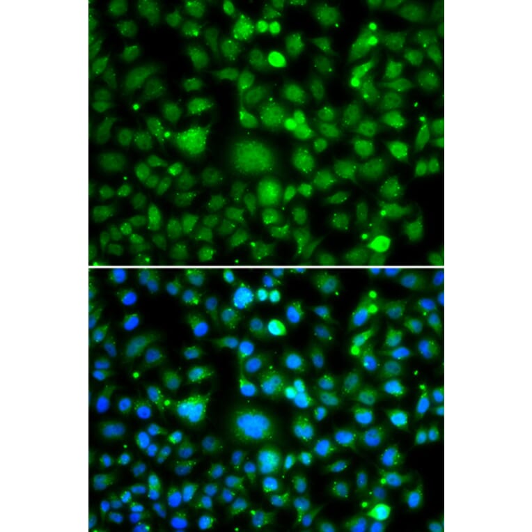 Immunofluorescence - Anti-TEK Antibody (A7222) - Antibodies.com
