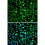 Immunofluorescence - Anti-TEK Antibody (A7222) - Antibodies.com