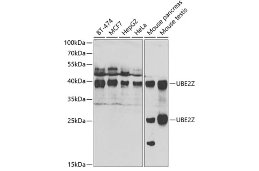 Western Blot - Anti-UBE2Z Antibody (A15605) - Antibodies.com