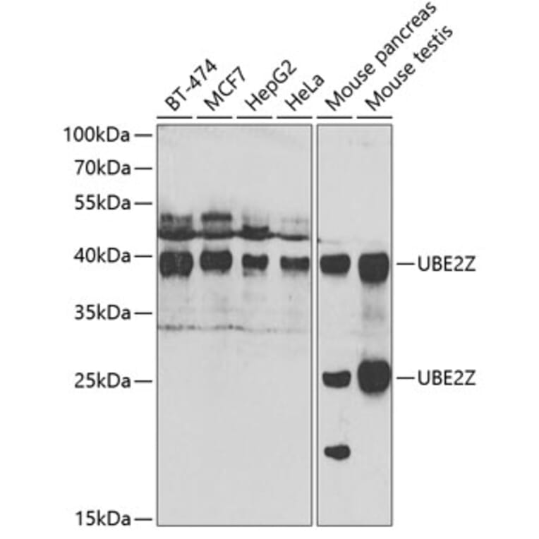 Western Blot - Anti-UBE2Z Antibody (A15605) - Antibodies.com