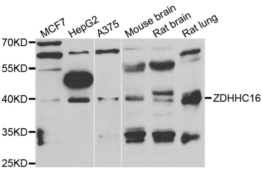 Western Blot - Anti-ZDHHC16 Antibody (A7226) - Antibodies.com