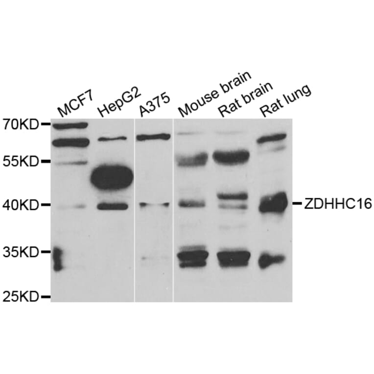 Western Blot - Anti-ZDHHC16 Antibody (A7226) - Antibodies.com
