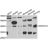 Western Blot - Anti-ZDHHC16 Antibody (A7226) - Antibodies.com