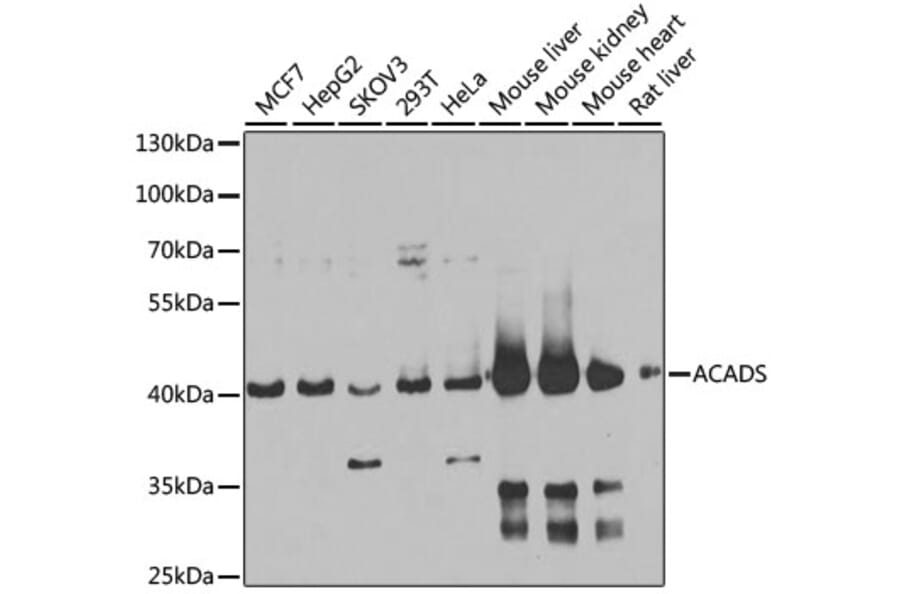 Western Blot - Anti-ACADS/SCAD Antibody (A15607) - Antibodies.com