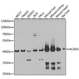 Western Blot - Anti-ACADS/SCAD Antibody (A15607) - Antibodies.com