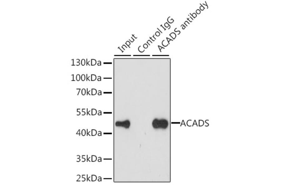 Western Blot - Anti-ACADS/SCAD Antibody (A15607) - Antibodies.com