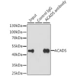 Western Blot - Anti-ACADS/SCAD Antibody (A15607) - Antibodies.com