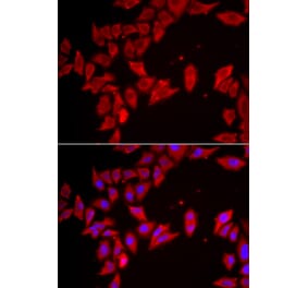 Immunofluorescence - Anti-SLC35A2 Antibody (A15608) - Antibodies.com