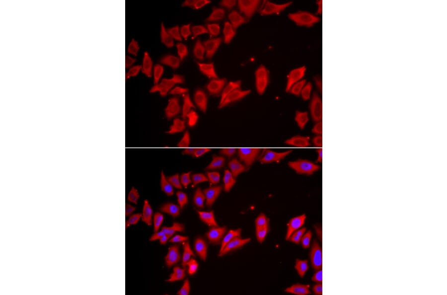 Immunofluorescence - Anti-SLC35A2 Antibody (A15608) - Antibodies.com