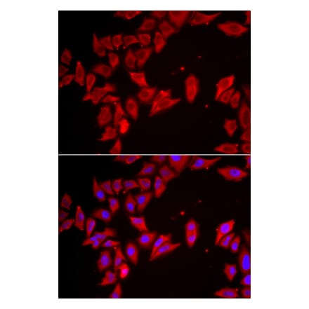 Immunofluorescence - Anti-SLC35A2 Antibody (A15608) - Antibodies.com