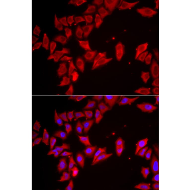 Immunofluorescence - Anti-SLC35A2 Antibody (A15608) - Antibodies.com