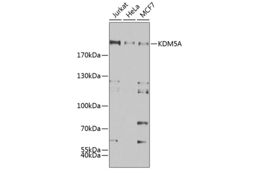 Western Blot - Anti-KDM5A/Jarid1A/RBBP2 Antibody (A15610) - Antibodies.com