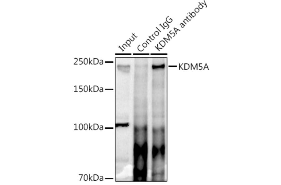 Western Blot - Anti-KDM5A/Jarid1A/RBBP2 Antibody (A15610) - Antibodies.com