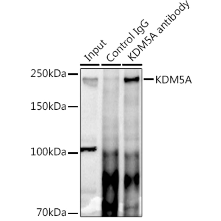 Western Blot - Anti-KDM5A/Jarid1A/RBBP2 Antibody (A15610) - Antibodies.com