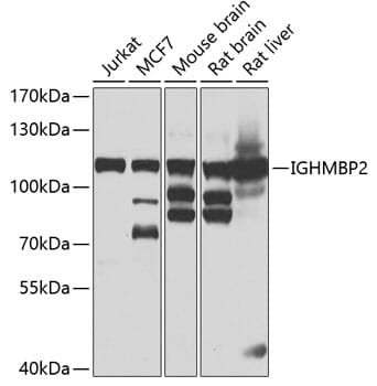 Western blot analysis of extracts of various cell lines, using Anti-IGHMBP2 Antibody (A7240) at 1:1,000 dilution.
Secondary antibody: Goat Anti-Rabbit IgG (H+L) (HRP) (AS014) at 1:10,000 dilution.
Lysates / proteins: 25µg per lane.
Blocking buffer: 3% non-fat dry milk in TBST.
Detection: ECL Basic Kit (RM00020).
Exposure time: 10s.