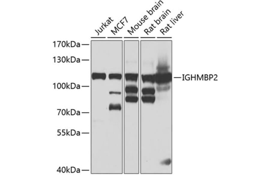 Western Blot - Anti-IGHMBP2 Antibody (A15612) - Antibodies.com