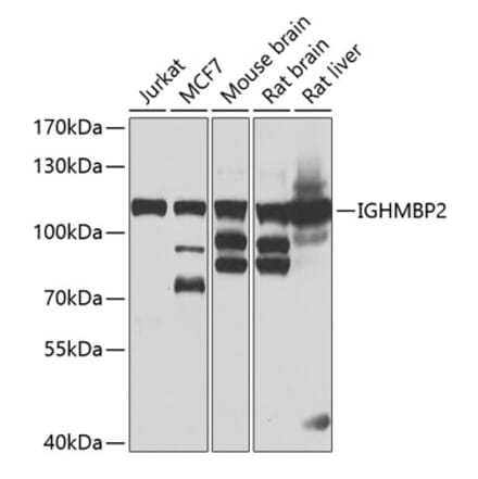 Western Blot - Anti-IGHMBP2 Antibody (A15612) - Antibodies.com