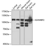 Western Blot - Anti-IGHMBP2 Antibody (A15612) - Antibodies.com
