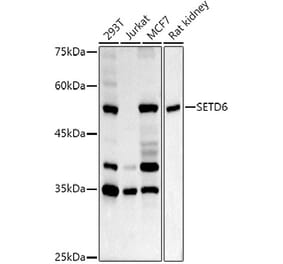 Western Blot - Anti-SETD6 Antibody (A15613) - Antibodies.com