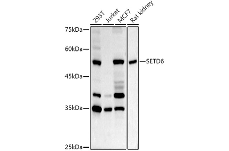 Western Blot - Anti-SETD6 Antibody (A15613) - Antibodies.com