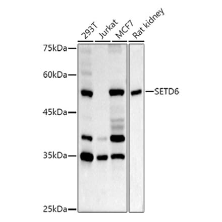 Western Blot - Anti-SETD6 Antibody (A15613) - Antibodies.com