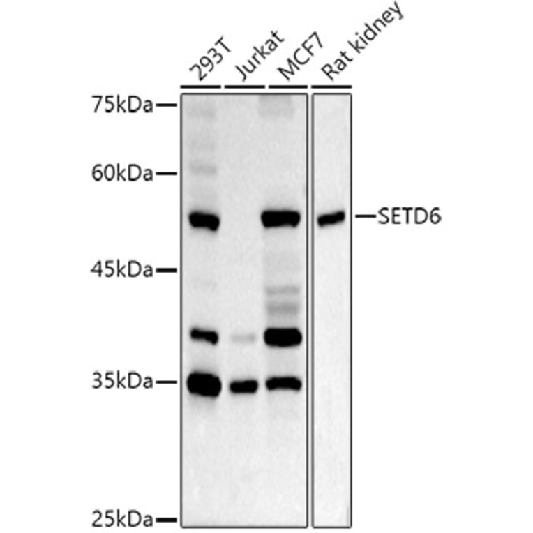 Western Blot - Anti-SETD6 Antibody (A15613) - Antibodies.com