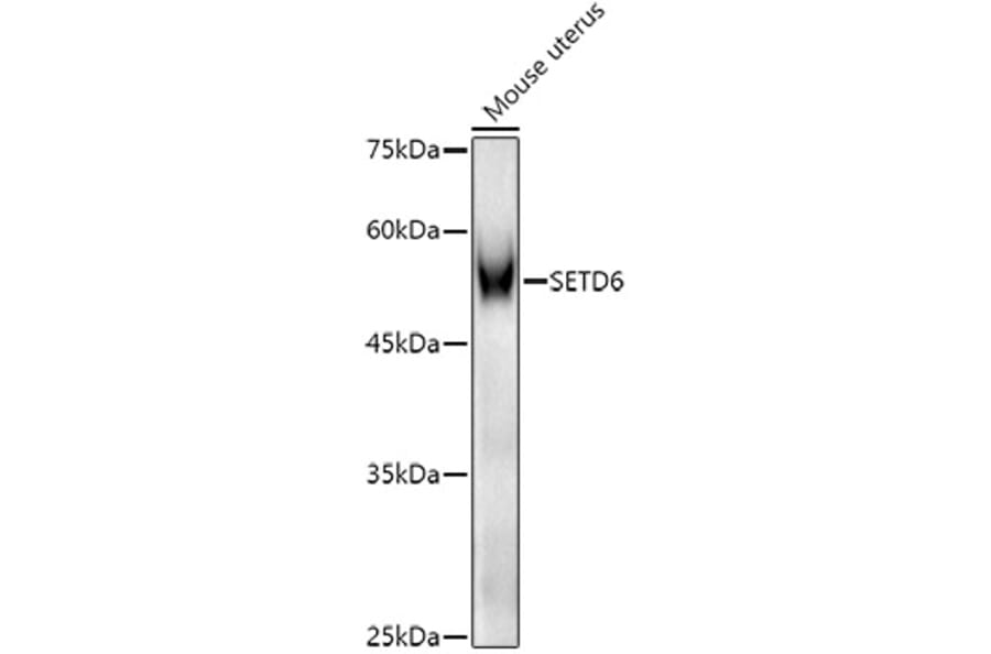 Western Blot - Anti-SETD6 Antibody (A15613) - Antibodies.com