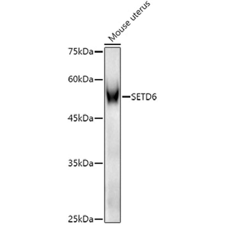 Western Blot - Anti-SETD6 Antibody (A15613) - Antibodies.com