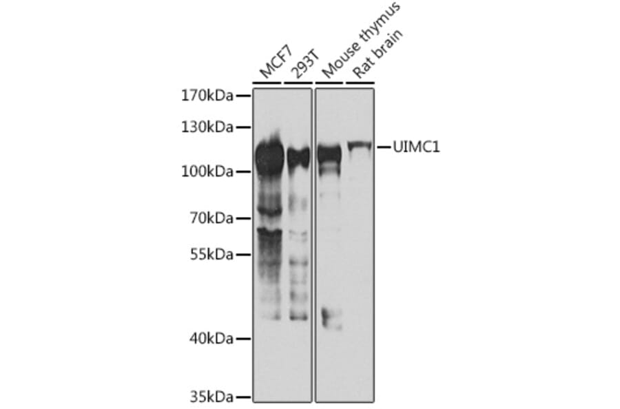 Western Blot - Anti-RAP80 Antibody (A15614) - Antibodies.com