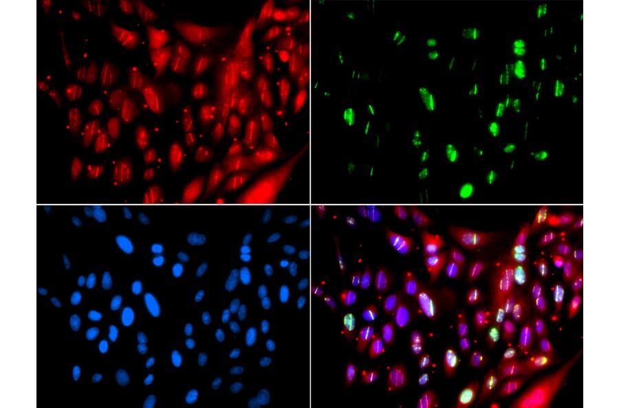 Immunofluorescence - Anti-RAP80 Antibody (A15614) - Antibodies.com