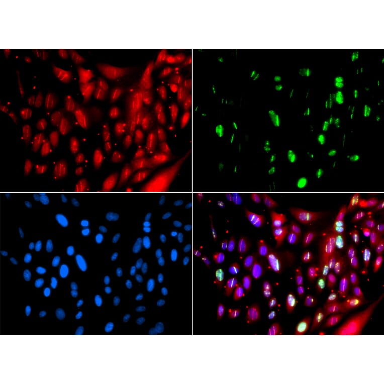 Immunofluorescence - Anti-RAP80 Antibody (A15614) - Antibodies.com
