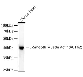 Western Blot - Anti-alpha smooth muscle Actin Antibody (A15615) - Antibodies.com
