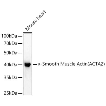 Western Blot - Anti-alpha smooth muscle Actin Antibody (A15615) - Antibodies.com