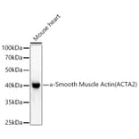 Western Blot - Anti-alpha smooth muscle Actin Antibody (A15615) - Antibodies.com